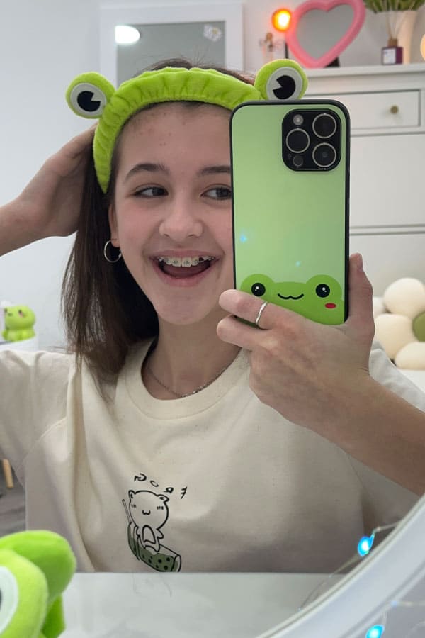 AVA'S FROG HEAD BAND SALE